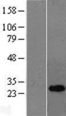 Western Blot: OIP5 Overexpression Lysate (Adult Normal) [NBL1-13920] Left-Empty vector transfected control cell lysate (HEK293 cell lysate); Right -Over-expression Lysate for OIP5.