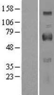 Western Blot: OIT3 Overexpression Lysate (Adult Normal) [NBL1-13921] Left-Empty vector transfected control cell lysate (HEK293 cell lysate); Right -Over-expression Lysate for OIT3.