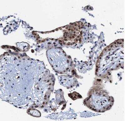 Immunohistochemistry-Paraffin OLAH Antibody - BSA Free
