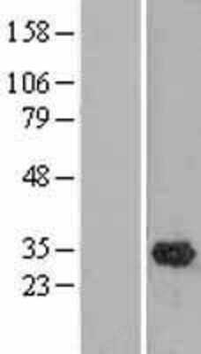 Western Blot: OLAH Overexpression Lysate (Adult Normal) [NBL1-13924] Left-Empty vector transfected control cell lysate (HEK293 cell lysate); Right -Over-expression Lysate for OLAH.