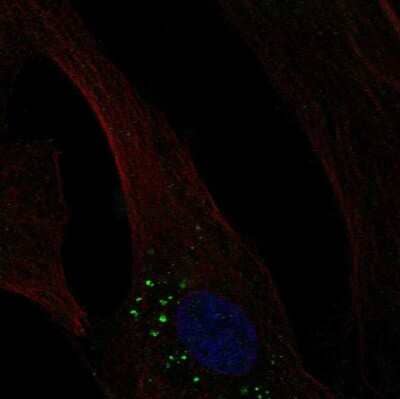 Immunocytochemistry/Immunofluorescence: OLFM-L3 Antibody [NBP2-68601] - Staining of human cell line LHCN-M2 shows localization to vesicles.