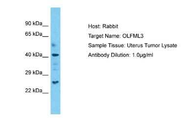 Western Blot: OLFM-L3 Antibody [NBP2-87981] - Host: Rabbit. Target Name: OLFML3. Sample Type: Uterus Tumor lysates. Antibody Dilution: 1.0ug/ml