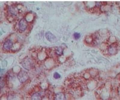 Immunohistochemistry-Paraffin: OLFM4 Antibody [NBP2-24535] - Analysis of OLFM4 in formalin-fixed, paraffin-embedded human liver tissue using OLFM4 antibody at 5 ug/ml.