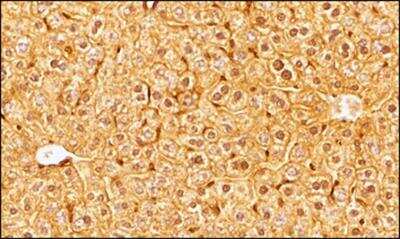 Immunohistochemistry-Paraffin: OLFM4 Antibody [NBP2-24535] - Tissue section of mouse liver using OLFM4 antibody at 2.5ug/ml concentration with HRP-DAB detection and hematoxylin counterstaining. The antibody generated nice staining in all the hepatocytes and the signal was localized specifically to the inter-cellular spaces, the nuclei and the cytoplasm.
