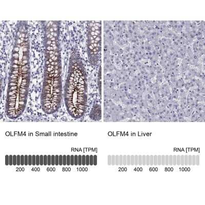 <b>Orthogonal Strategies Validation. </b>Immunohistochemistry-Paraffin: OLFM4 Antibody [NBP2-62720] - Analysis in human small intestine and liver tissues using Anti-OLFM4 antibody. Corresponding OLFM4 RNA-seq data are presented for the same tissues.