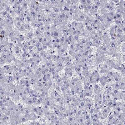 Immunohistochemistry-Paraffin: OLFM4 Antibody [NBP2-62720] - Staining of human liver shows low expression as expected.