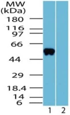 Western Blot: OLFM4 Antibody [NBP2-24535] - Analysis of human OLFM4 in human liver lysate in the 1) absence and 2) presence of immunizing peptide using OLFM4 antibody at 2 ug/ml.
