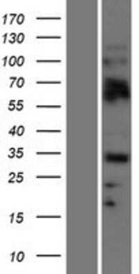 Western Blot: OLIG2 Overexpression Lysate (Adult Normal) [NBP2-07699] Left-Empty vector transfected control cell lysate (HEK293 cell lysate); Right -Over-expression Lysate for OLIG2.