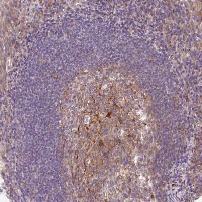 Immunohistochemistry-Paraffin: OMA1 Antibody [NBP2-30971] - Staining of human lymphoid tissues shows moderate granular cytoplasmic positivity in germinal center cells.