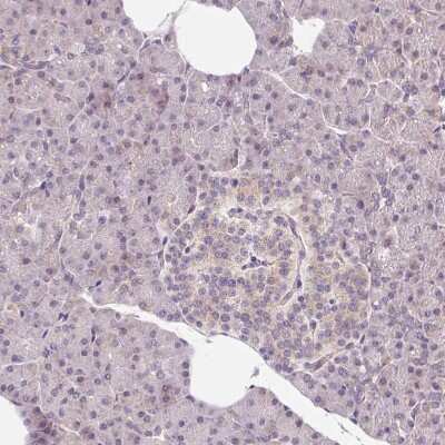 Immunohistochemistry-Paraffin: OMA1 Antibody [NBP2-30971] - Staining of human pancreas shows low positivity in exocrine glandular cells as expected.