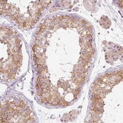 Immunohistochemistry-Paraffin: OMA1 Antibody [NBP2-30971] - Staining of human testis shows moderate granular cytoplasmic positivity in cells in seminiferous ducts.