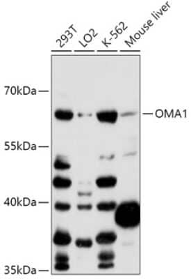 Western Blot: OMA1 Antibody [NBP2-94293] - Analysis of extracts of various cell lines, using OMA1 at 1:1000 dilution.Secondary antibody: HRP Goat Anti-Rabbit IgG (H+L) at 1:10000 dilution.Lysates/proteins: 25ug per lane.Blocking buffer: 3% nonfat dry milk in TBST.Detection: ECL Basic Kit .Exposure time: 60s.