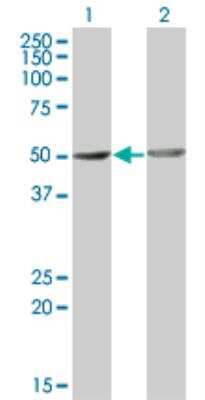 Western Blot: OMD Antibody (1E10) [H00004958-M01] - analysis of OMD expression in transfected 293T cell line by OMD monoclonal antibody (M01), clone 1E10. Lane 1: OMD transfected lysate (49.5 KDa). Lane 2: Non-transfected lysate.