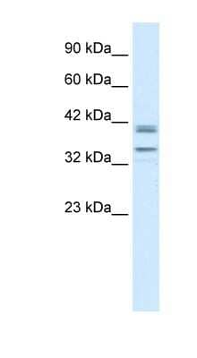 Western Blot: ONECUT3 Antibody [NBP1-91529] - Titration: 0.2-1 ug/ml, Positive Control: Jurkat cell lysate.