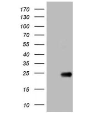 Western Blot: OPA3 Antibody (OTI3G4) - Azide and BSA Free [NBP2-73147] - HEK293T cells were transfected with the pCMV6-ENTRY control (Left lane) or pCMV6-ENTRY OPA3 ( Right lane) cDNA for 48 hrs and lysed. Equivalent amounts of cell lysates (5 ug per lane) were separated by SDS-PAGE and immunoblotted with antiOPA3.(1:2000)