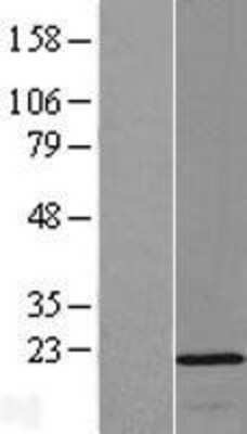 Western Blot OPA3 Overexpression Lysate