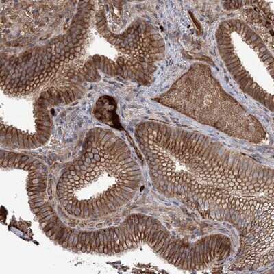 Immunohistochemistry-Paraffin: OPAL1 Antibody [NBP1-93988] - Staining of human gall bladder shows strong cytoplasmic and membranous positivity in glandular cells.