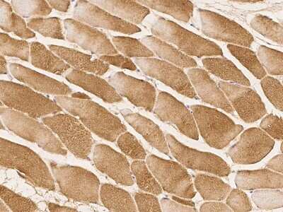 Immunohistochemistry-Paraffin: OPAL1 Antibody [NBP2-98185] - Immunochemical staining of human OPAL1 in human skeletal muscle with rabbit polyclonal antibody at 1:100 dilution, formalin-fixed paraffin embedded sections.
