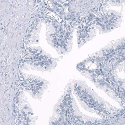 Immunohistochemistry-Paraffin: OPALIN Antibody (CL11142) [NBP3-07995] - Staining of human prostate shows no positivity in glandular cells as expected.