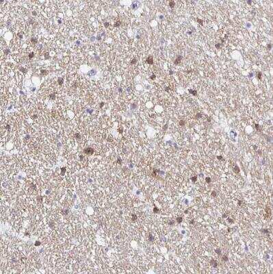 Immunohistochemistry-Paraffin OPALIN Antibody