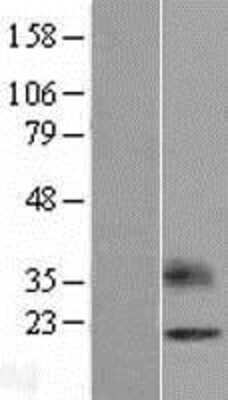 Western Blot OPALIN Overexpression Lysate