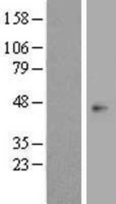 Western Blot: OPCML Overexpression Lysate (Adult Normal) [NBP2-08098] Left-Empty vector transfected control cell lysate (HEK293 cell lysate); Right -Over-expression Lysate for OPCML.