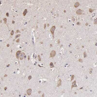 Immunohistochemistry-Paraffin: OPHN1 Antibody [NBP1-88828] - Staining of human cerebral cortex shows moderate cytoplasmic positivity in neuronal cells.