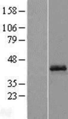 Western Blot: OPTC Overexpression Lysate (Adult Normal) [NBL1-13948] Left-Empty vector transfected control cell lysate (HEK293 cell lysate); Right -Over-expression Lysate for OPTC.