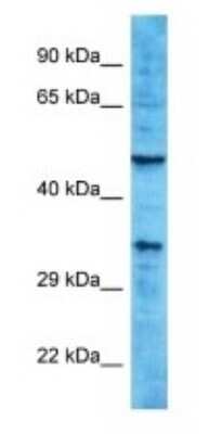 Western Blot: OR10A2 Antibody [NBP3-09843] - Western blot analysis of OR10A2 in HCT15 Whole Cell lysates. Antibody dilution at 1.0ug/ml