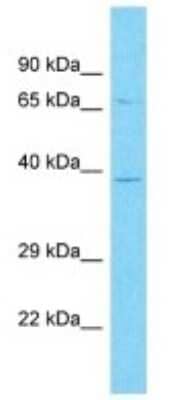 Western Blot: OR10A3 Antibody [NBP3-09844] - Western blot analysis of OR10A3 in Hela Whole Cell lysates. Antibody dilution at 1.0ug/ml