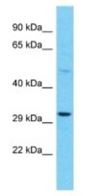 Western Blot OR10A4 Antibody