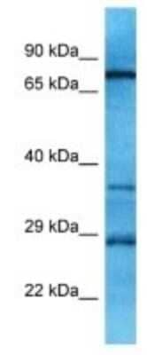Western Blot: OR10A6 Antibody [NBP3-09846] - Western blot analysis of OR10A6 in MCF7 Whole Cell lysates. Antibody dilution at 1.0ug/ml
