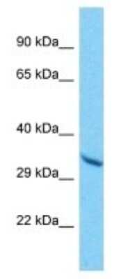 Western Blot: OR10A6 Antibody [NBP3-09847] - Western blot analysis of OR10A6 in A549 Whole Cell lysates. Antibody dilution at 1.0ug/ml