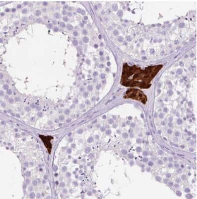 Immunohistochemistry: OR10A7 Antibody [NBP2-30798] - Staining of human testis shows strong cytoplasmic and nuclear positivity in Leydig cells.