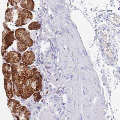 Immunohistochemistry-Paraffin: OR10D3 Antibody [NBP2-14700] - Staining of human stomach, lower shows strong cytoplasmic positivity in glandular cells.