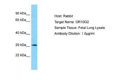 Western Blot: OR10G2 Antibody [NBP2-84197] - Host: Rabbit. Target Name: OR10G2. Sample Type: Fetal Lung lysates. Antibody Dilution: 1.0ug/ml