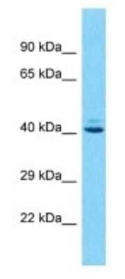 Western Blot: OR10J1 Antibody [NBP3-09854] - Western blot analysis of OR10J1 in Jurkat Whole Cell lysates. Antibody dilution at 1.0ug/ml