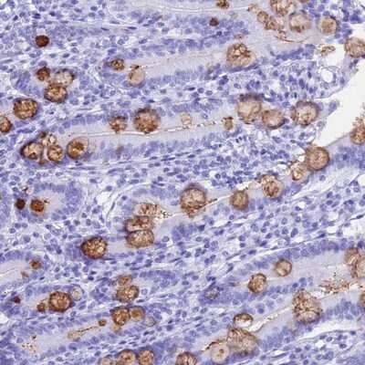 Immunohistochemistry-Paraffin: OR10J3 Antibody [NBP1-92222] Staining of human duodenum shows strong cytoplasmic positivity in glandular cells.