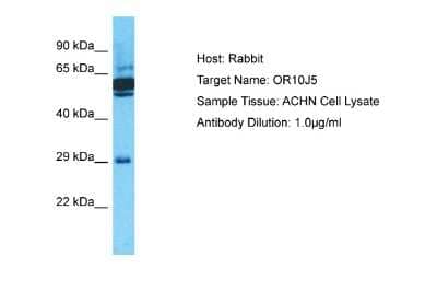 Western Blot: OR10J5 Antibody [NBP2-84198] - Host: Rabbit. Target Name: OR10J5. Sample Type: ACHN Whole Cell lysates. Antibody Dilution: 1.0ug/ml