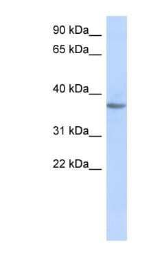 Western Blot: OR10X1 Antibody [NBP1-59629] - Human Muscle lysate, concentration 0.2-1 ug/ml.