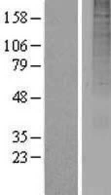 Western Blot: OR13A1 Overexpression Lysate (Adult Normal) [NBP2-08933] Left-Empty vector transfected control cell lysate (HEK293 cell lysate); Right -Over-expression Lysate for OR13A1.