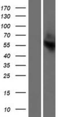 Western Blot: OR13C2 Overexpression Lysate (Adult Normal) [NBP2-08875] Left-Empty vector transfected control cell lysate (HEK293 cell lysate); Right -Over-expression Lysate for OR13C2.