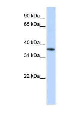 Western Blot: OR13C5 Antibody [NBP1-79975] - Human Liver cell lysate, concentration 0.2-1 ug/ml.