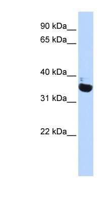 Western Blot: OR13C5 Antibody [NBP1-79994] - Human Heart lysate, concentration 0.2-1 ug/ml.