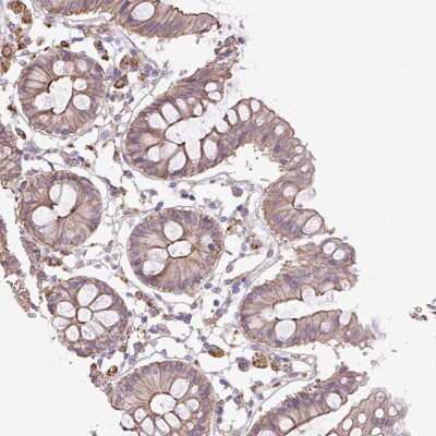 Immunohistochemistry: OR13D1 Antibody [NBP2-49203] - Staining of human colon shows moderate membranous positivity in glandular cells.