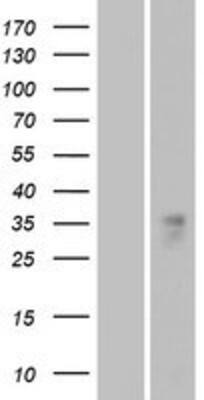 Western Blot: OR1B1 Overexpression Lysate (Adult Normal) [NBP2-08868] Left-Empty vector transfected control cell lysate (HEK293 cell lysate); Right -Over-expression Lysate for OR1B1.