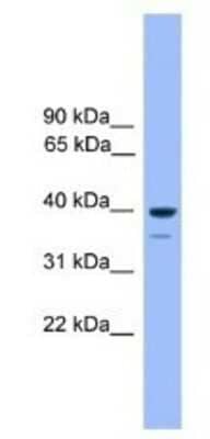 Western Blot: OR1C1 Antibody [NBP1-69093] - 721_B Cell Lysate 1ug/ml  Gel Concentration 12%