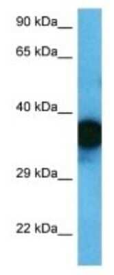 Western Blot: OR1F1 Antibody [NBP3-09758] - Western blot analysis of OR1F1 in Jurkat Whole Cell. Antibody dilution at 1.0ug/ml