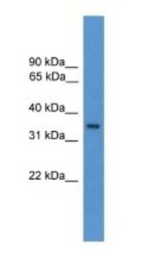 Western Blot: OR1J1 Antibody [NBP1-69092] - Titration: 1.0 ug/ml Positive Control: Hela Whole Cell.