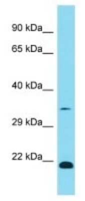Western Blot: OR1K1 Antibody [NBP3-09759] - Western blot analysis of OR1K1 in Fetal Lung lysates. Antibody dilution at 1.0ug/ml
